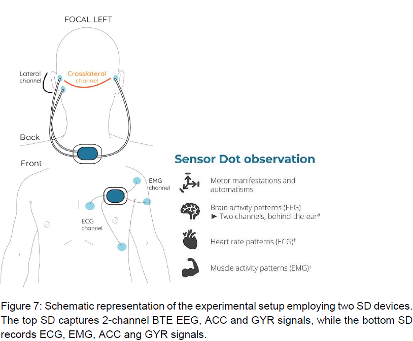 Schematic setup of wearable sensors for seizure detection